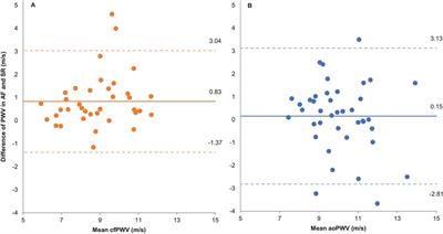 Assessment of aortic stiffness during atrial fibrillation: solutions and considerations